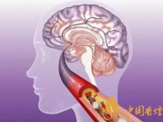 吸烟埋祸根，中年中风找上门