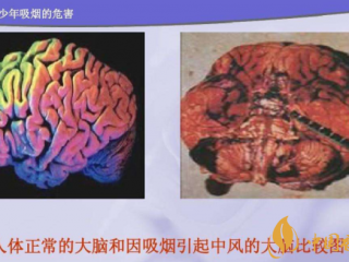 吸烟对身体有哪些危害 吸烟对大脑有什么危害(影响智力记忆力)